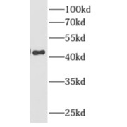 WB analysis of urkat cells, using AMMECR1 antibody (1/600 dilution).