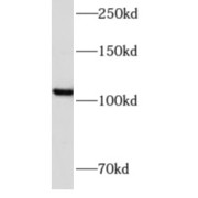 WB analysis of HeLa cells, using AMOTL1 antibody (1/500 dilution).