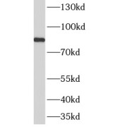 WB analysis of mouse kidney tissue, using AMPD3 antibody (1/1000 dilution).