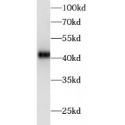 WB analysis of MCF-7 cells, using AREG antibody (1/600 dilution).