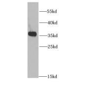 WB analysis of human brain tissue, using PRKAB2 antibody (1/1000 dilution).