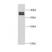 WB analysis of K-562 cells, using PRKAG1 antibody (1/1000 dilution).