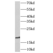 WB analysis of human vein tissue, using ANG antibody (1/300 dilution).