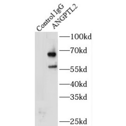 Angiopoietin-Related Protein 2 (ANGPTL2) Antibody
