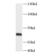 WB analysis of mouse small intestine tissue, using ANGPTL2 antibody (1/500 dilution).