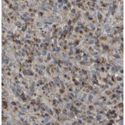 Angiopoietin-Related Protein 5 (ANGPTL5) Antibody