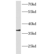 WB analysis of human heart tissue, using ANKRD1 antibody (1/400 dilution).