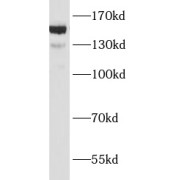 WB analysis of BxPC-3 cells, using ANKRD11 antibody (1/500 dilution).