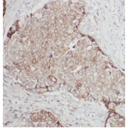 IHC-P analysis of human ovary tissue, using anti- ANKRD26 antibody (1/50 dilution).