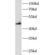 WB analysis of Y79 cells, using ANKRD33 antibody (1/600 dilution).