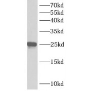 WB analysis of PC-3 cells, using ANKRD39 antibody (1/300 dilution).
