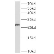 WB analysis of MCF-7 cells, using ANKRD49 antibody (1/600 dilution).