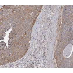 Ankyrin Repeat Domain 55 (ANKRD55) Antibody