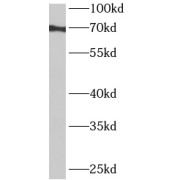 WB analysis of HeLa cells, using ANKRD55 antibody (1/600 dilution).