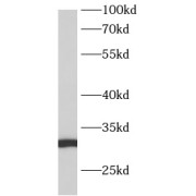 WB analysis of human testis tissue, using ANKRD7 antibody (1/300 dilution).