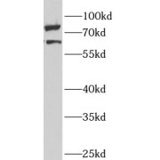 WB analysis of mouse liver tissue, using ANKS3 antibody (1/1000 dilution).