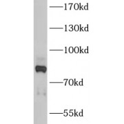 WB analysis of BxPC-3 cells, using ANKZF1 antibody (1/2000 dilution).