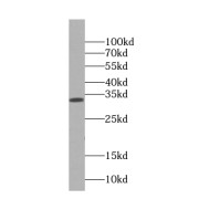 WB analysis of human heart tissue, using Annexin IV antibody (1/1000 dilution).