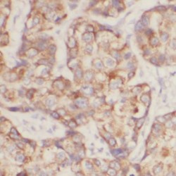 Anoctamin-2 (ANO2) Antibody