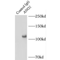 Anoctamin-2 (ANO2) Antibody