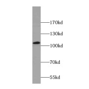 WB analysis of mouse brain tissue, using ANO2 antibody (1/500 dilution).