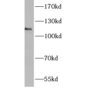 WB analysis of mouse ovary tissue, using ANO3 antibody (1/500 dilution).