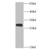 WB analysis of human brain tissue, using ANP32A antibody (1/1000 dilution).