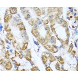 Anthrax Toxin Receptor 2 (ANTXR2) Antibody