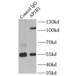 AP-1 Complex Subunit Beta-1 (AP1B1) Antibody