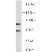 WB analysis of THP-1 cells, using AP1G2 antibody (1/500 dilution).