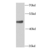 WB analysis of mouse colon tissue, using AP1M2 antibody (1/1000 dilution).