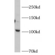 WB analysis of mouse brain tissue, using AP2A2 antibody (1/500 dilution).