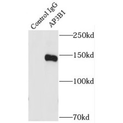 AP-3 Complex Subunit Beta-1 (AP3B1) Antibody