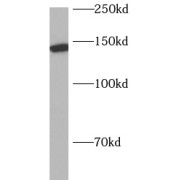 WB analysis of mouse thymus tissue, using AP3B1 antibody (1/500 dilution).