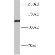 WB analysis of rat brain tissue, using AP3B2 antibody (1/600 dilution).
