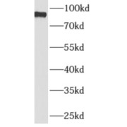 WB analysis of human brain tissue, using APBB2 antibody (1/300 dilution).