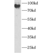 WB analysis of MCF7 cells, using ANAPC2 antibody (1/500 dilution).