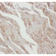 IHC-P analysis of mouse heart tissue, using anti- Apelin antibody (1/200 dilution).