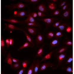 DNA-(Apurinic Or Apyrimidinic Site) Lyase (APEX1) Antibody