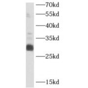 WB analysis of mouse liver, using APIP antibody (1/1000 dilution).