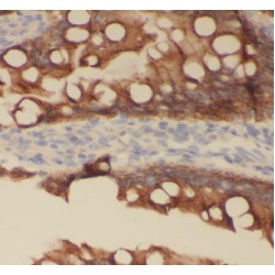 Apelin Receptor (APLNR) Antibody