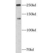 WB analysis of mouse liver tissue, using APOB antibody (1/600 dilution).