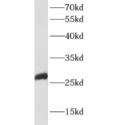 WB analysis of mouse skeletal muscle tissue, using APOBEC2 antibody (1/500 dilution).