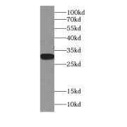 WB analysis of human plasma tissue, using APOD antibody (1/20000 dilution).