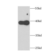 WB analysis of human blood tissue, using APOL1 antibody (1/1000 dilution).