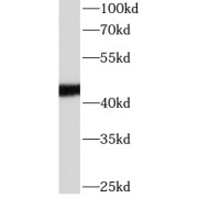 WB analysis of human plasma tissue (1 µg), using APOL1 antibody (1/50000 dilution).