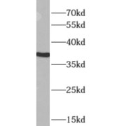 WB analysis of A549 cells, using APOL2 antibody (1/2000 dilution).