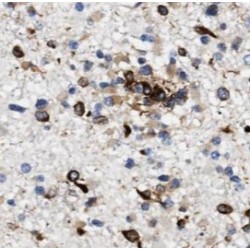 Beta-Amyloid Precursor Protein (APP) Antibody