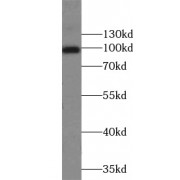 WB analysis of HEK-293 cells, using APP antibody (1/1000 dilution).