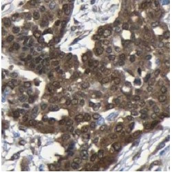 DCC-Interacting Protein 13-Alpha (APPL1) Antibody